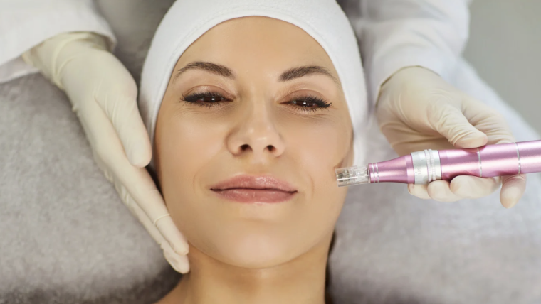 Microneedling Appointment in Falls Church, Virginia